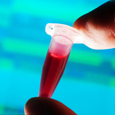 Εγκεκριμένη FDA εξεταστική υπηρεσία επικύρωσης τρίτου μπουκαλιών μωρών επαφών τροφίμων εργαστηριακής γρήγορη ανίχνευσης